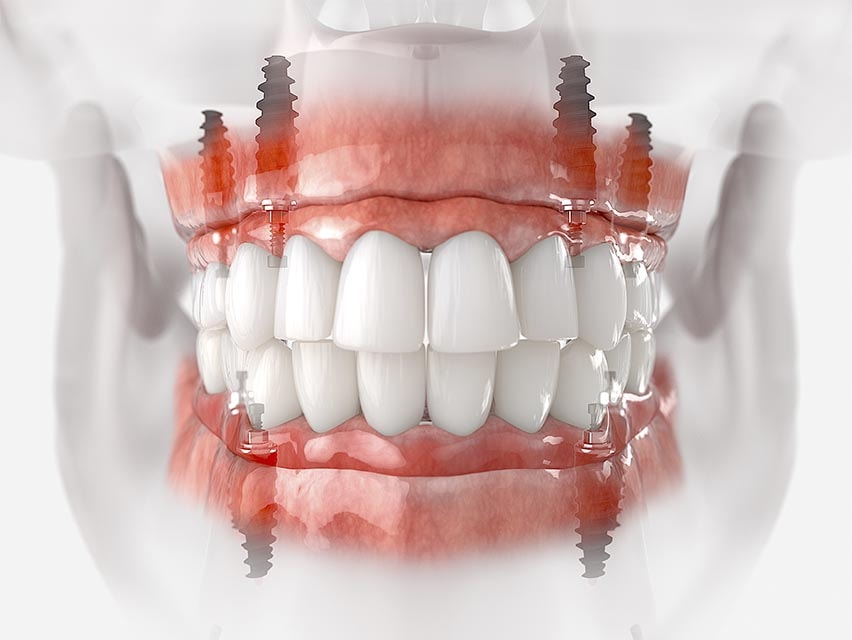 Planejamento de protocolo odontológico em Curitiba.